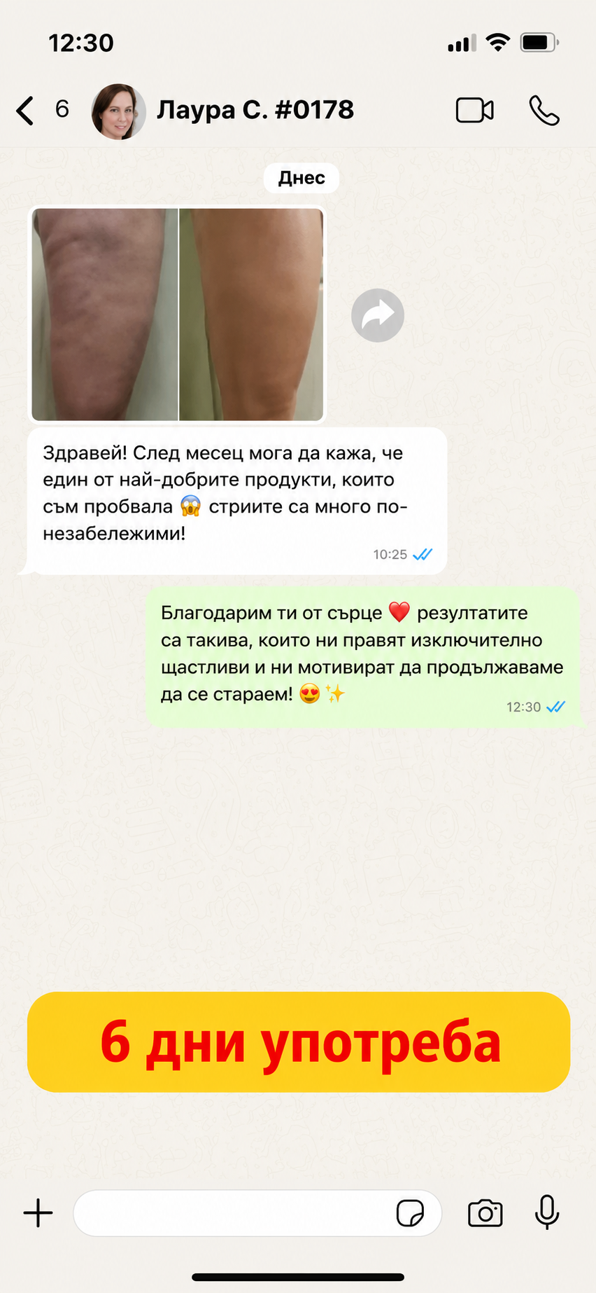 Cellulite-IT-6.png
