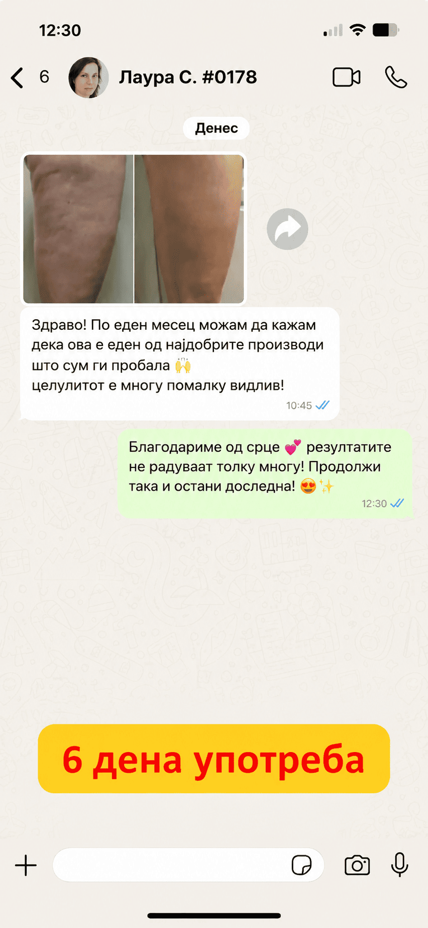 Cellulite-IT-6.png