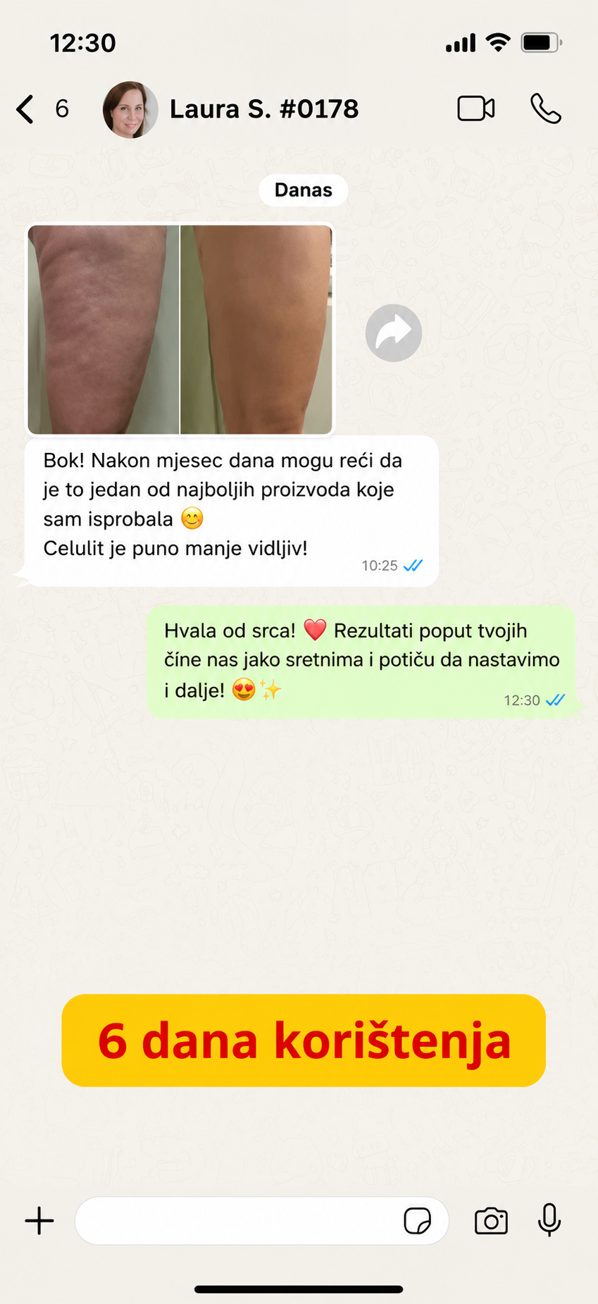 Cellulite-IT-6.png